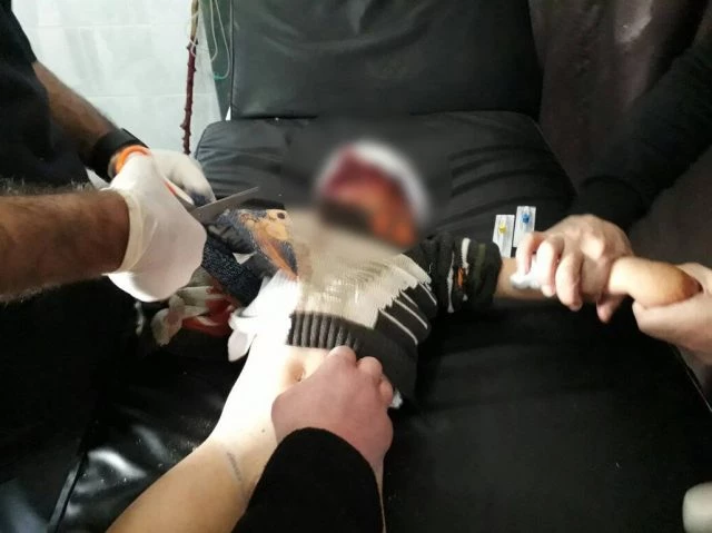 Οι Τούρκοι σφαγιάζουν αμάχους και μωρά στην Aφρίν – Σοκαριστικές εικόνες (βίντεο)